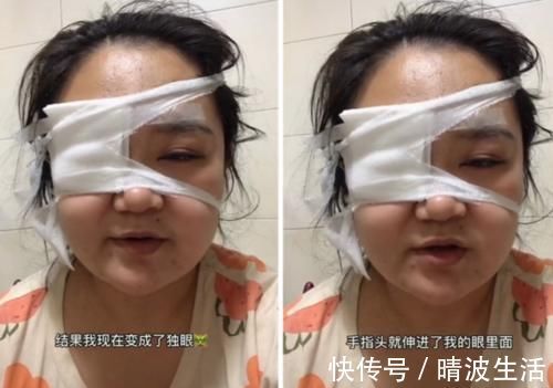 孩子|剖腹七层生下你,你却让我变“独眼”,宝妈:别让孩子伤害了你