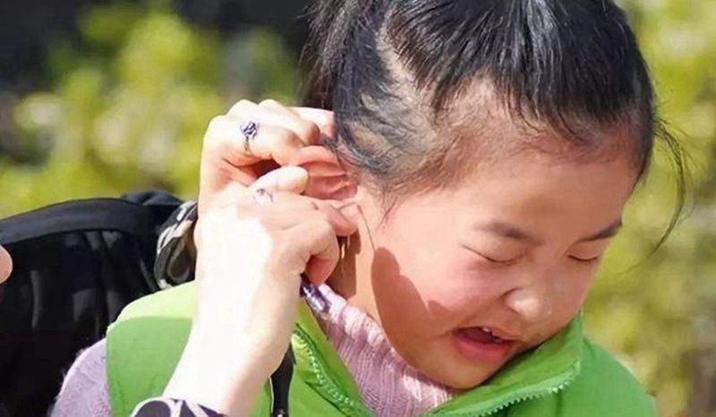 孩子|到底该不该经常给孩子掏“耳垢”？要区分年龄，做错了容易伤到娃