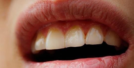 衰老|女人这三个地方变大，别急着开心，可能是衰老的象征，看你中招没