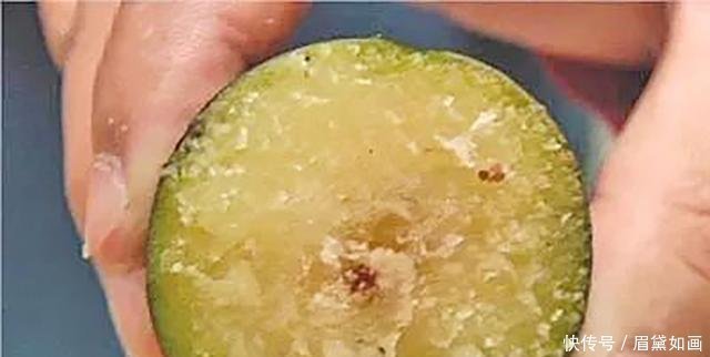 红薯|这5种食物别再吃了，医生忠告能不吃就别吃了，因为寄生虫最多