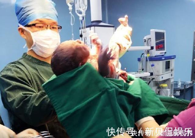 宝宝|宝宝出生就冲着妈妈笑,却被医生一巴掌打哭,婆婆得知后连忙道谢