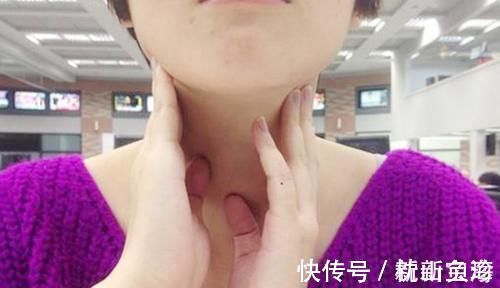 卷心菜|甲状腺出现结节后，要避开几种食物，再爱吃也要忍住