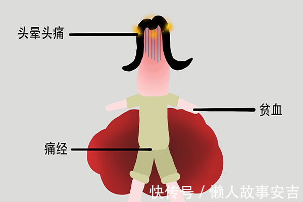 营养物质|轻度脑梗的信号是什么？身体的“求救信号”别忽视，趁早就医