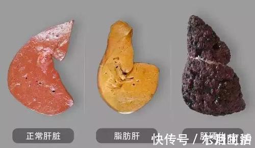 养肝护肝|医生:肝不好的人,这几种水果可以多吃点,或能帮助修复肝功能