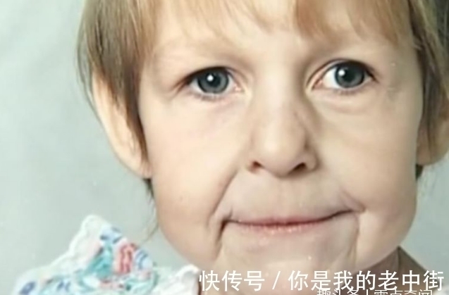 卡蒂亚|刚出生的婴儿满脸皱纹,医生说活不到1岁,21年后奇迹发生了