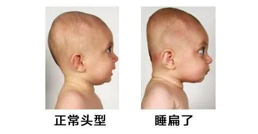 圆头|为了给宝宝睡成圆头，闺蜜和妈妈闹翻了