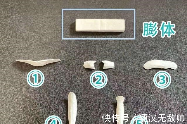 恢复 隆鼻术后有哪些注意事项术后怎么样恢复的!