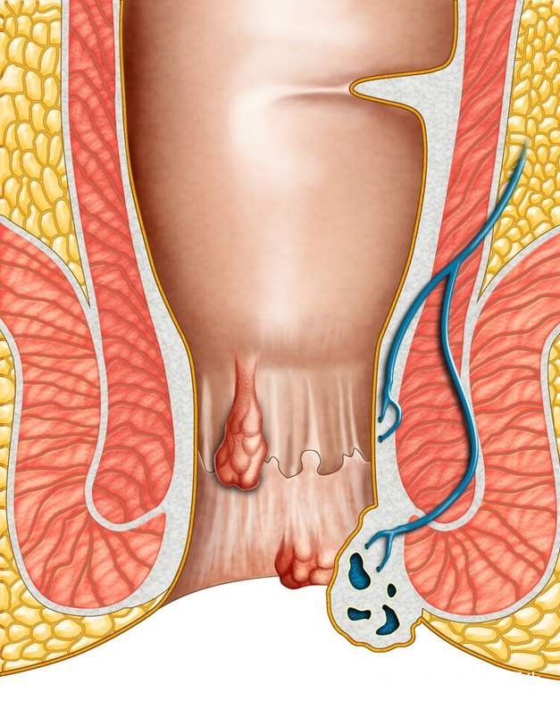 妇科医生|女子头晕半年,以为患癌症,检查结果让她觉得重获新生