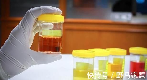 男性|男人早上起床第一次小便,如果没有三个迹象,肾脏可能会很强壮!