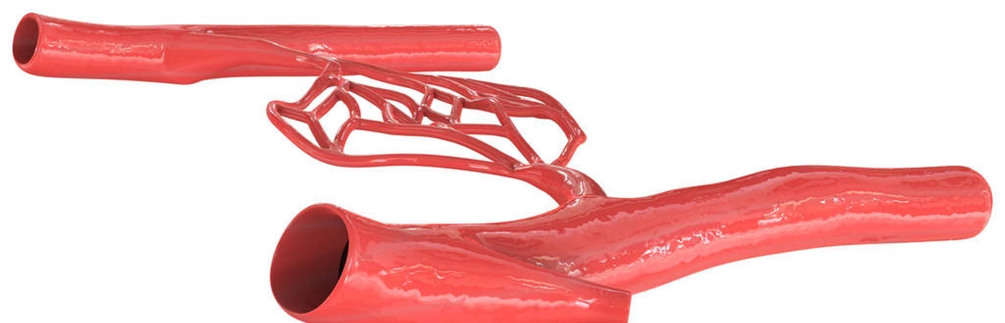 面条|患有高血脂,2种主食劝你少吃,滋养血管,稳定血脂水平