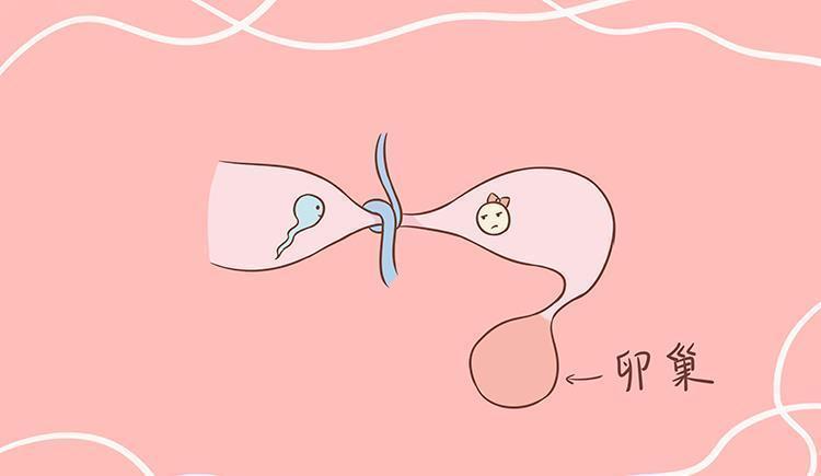 不孕不育|这三种避孕方法很有效,女性最好选择第三种,可别怕浪费钱