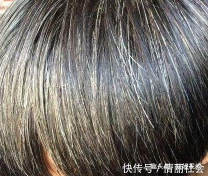 白发|一把花椒就能改善白头发中医告诉你真相，预防白发让头发变健康