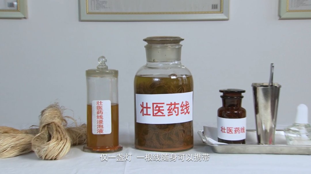 广西中医学院|科普｜八桂中医大讲堂（22）：壮医药线点灸巧治红眼病