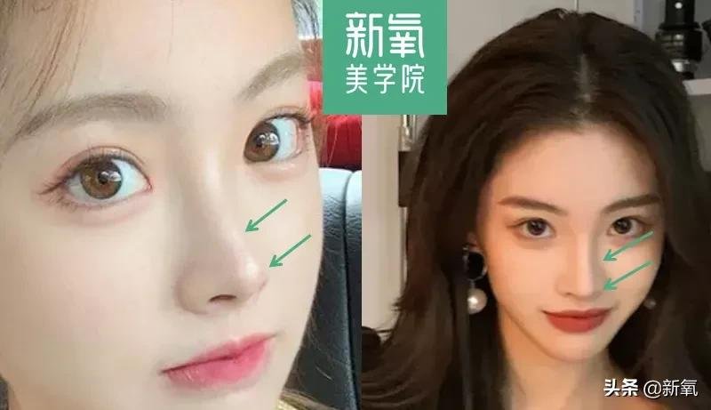 孙一宁|她do了五年脸，终于成为2021年度互联网美女