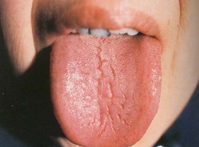 津不上承|老中医告诉你一到晚上就口干口渴的厉害是怎么回事