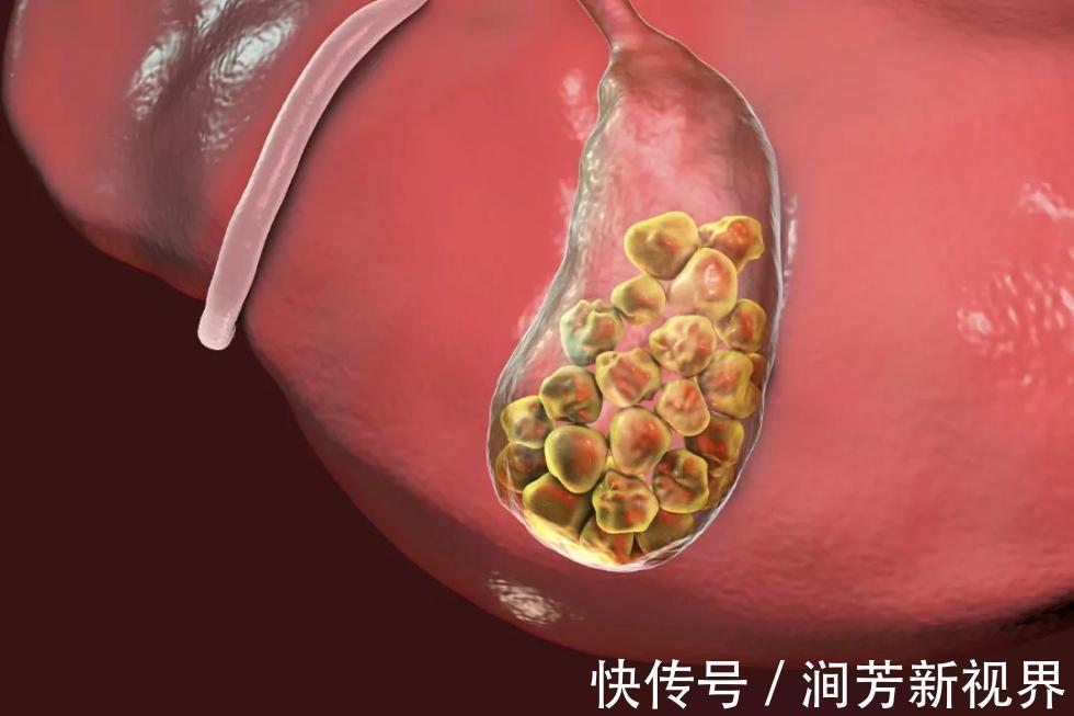 汪小欢|胃真的会越撑越大，越饿越小没想到真相竟是…