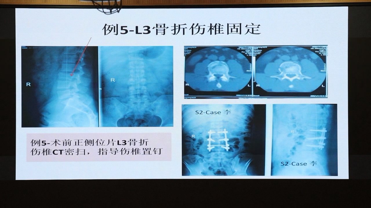 讲座|会同县人民医院邀请省专家开展业务专题讲座