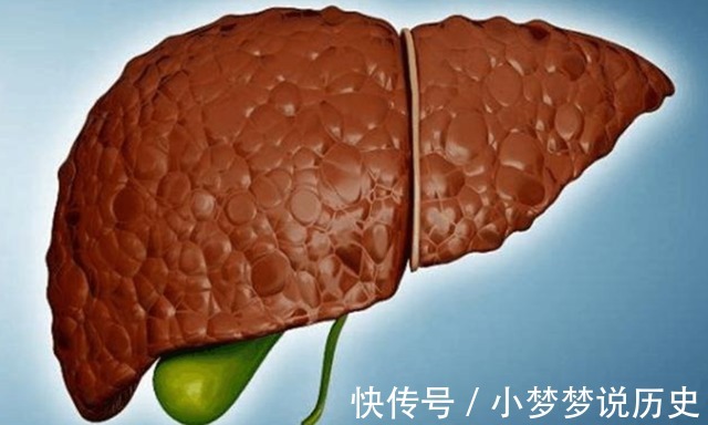 肝脏|江苏一女子，坚持每天吃胡萝卜养肝，5个月后，肝脏怎么样了