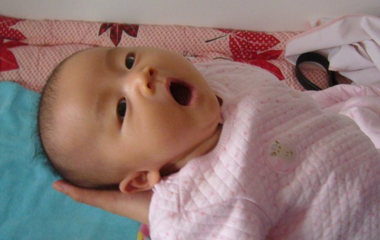 儿媳|两个月大的婴儿身体发臭,医生查出结果,婆婆怒斥儿媳无知