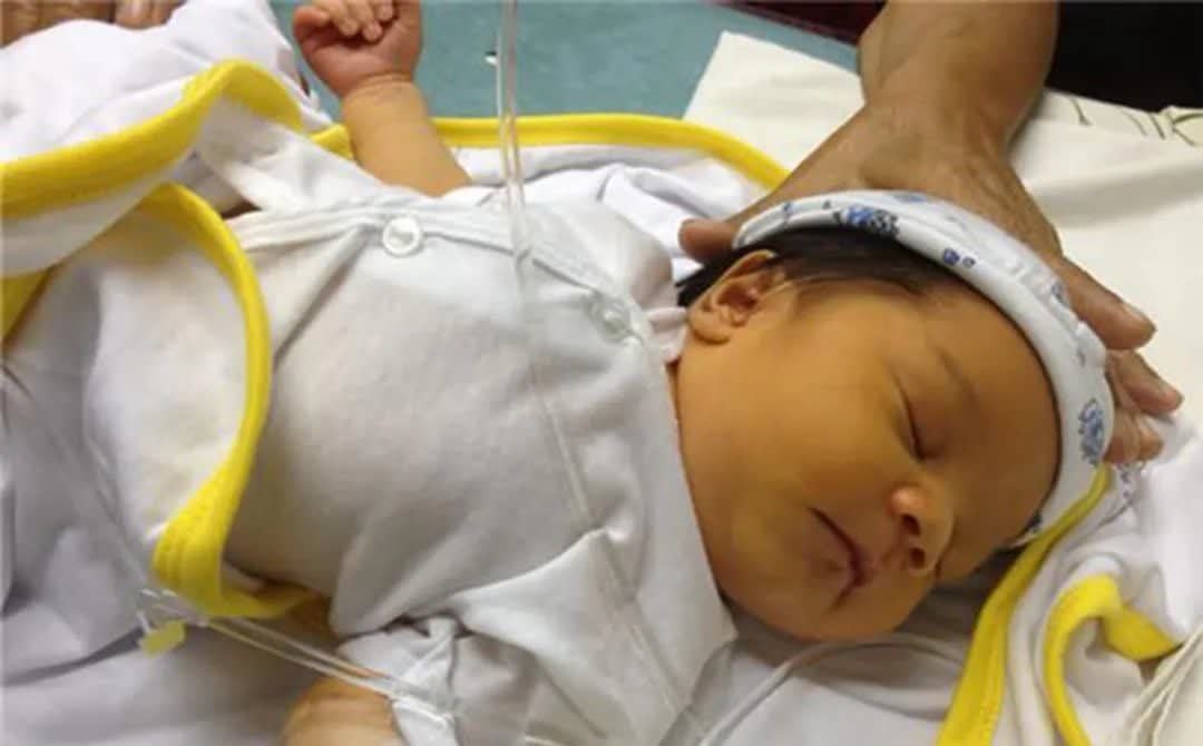 病理性黄疸|新生儿为什么会出现黄疸?该如何应对?关于黄疸你想知道的在这里