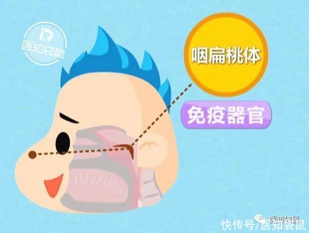 身高|腺样体肥大别大意，拉低颜值、影响身高和智商！这种情况得手术