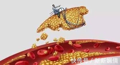 黑豆|血液太稠，担心高血脂，它们被称为血液清洁工，赶走血液里的垃圾