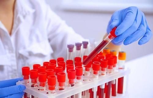  保护好肾功能，不能只看血肌酐，别忽视了这3项指标的稳定