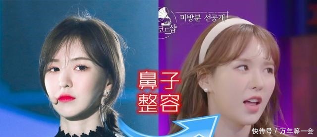 RedVelvet的Wendy被指做了鼻子整形手术，粉丝请不要负评！