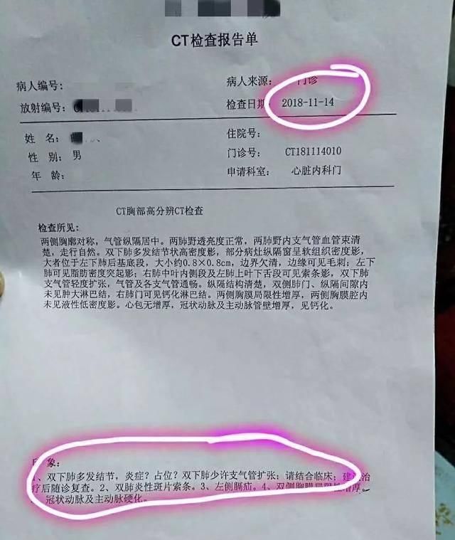 醫生說,發現肺結節基本沒啥大事,但出現這5個癥狀要及時防治!