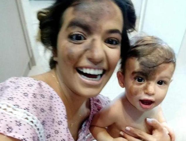 泪目|女子生下“蝙蝠侠”,亲戚朋友不敢靠近,父母的举动却让人泪目