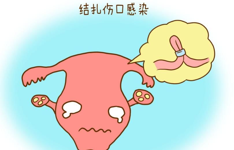  有益|5种避孕方法, 第2种最伤害身体, 第5种安全有效还有益女性健康