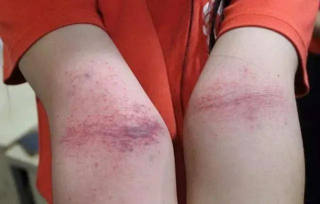 八虚|人体有8虚,学会拍一拍,清肺气化肝郁健脾胃通经络,百病远离!