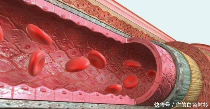 心脑血管疾病|引起心脑血管意外的因素有哪些