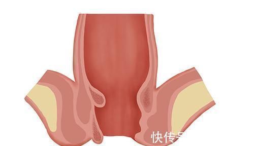 炎症|男性前列腺有问题，该做哪些男科检查保护前列腺，做什么好