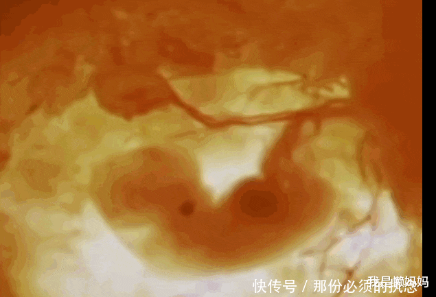 胎儿|怀孕前三个月有必要半个月做一次B超检查吗？