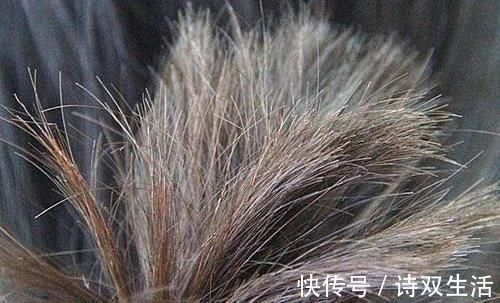 是真的吗|长白头发的人,比正常人的患癌风险低,是真的吗医生告诉你答案