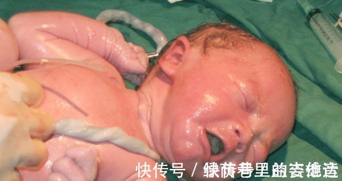 脐带|脐带绕颈与睡觉翻身无关,原因只有这三个,孕妇要牢记