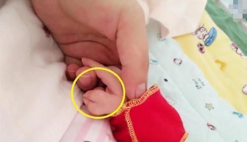 畸形|孕检结果正常,却生出畸形宝宝,怀孕多少周做排畸检查准确率最高