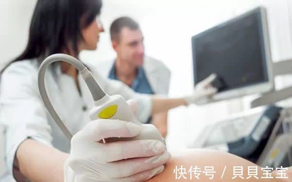 顺产|还没出生就会“坑妈”?宝宝脐带绕颈,宝妈就没法顺产了?