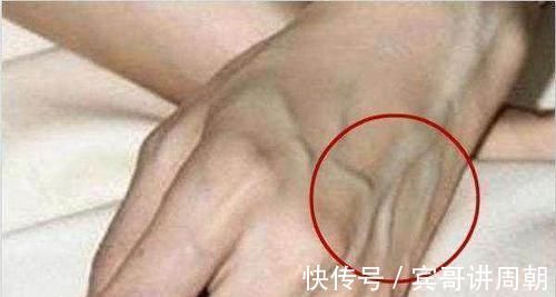 多酚化合物|无论男女开始衰老,多从手开始!手上出现3异象,说明衰老将至