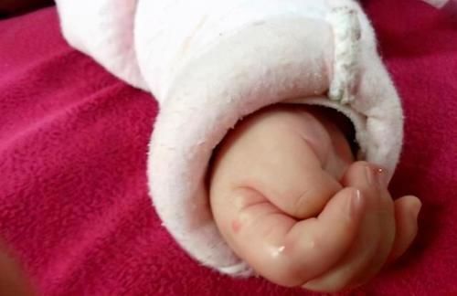 大脑|宝宝拇指内扣,大脑会很笨?超过这个月龄没好转,就该及时就医