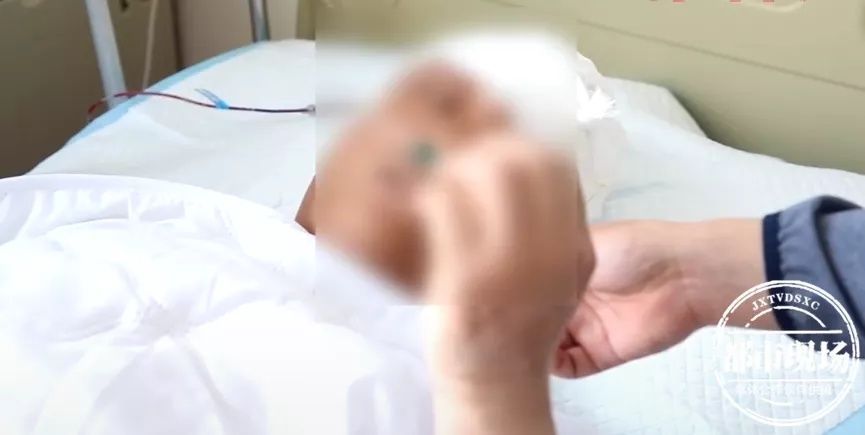 眉心|可怕！男子干活时，1个钉子突然射中眉心进入大脑