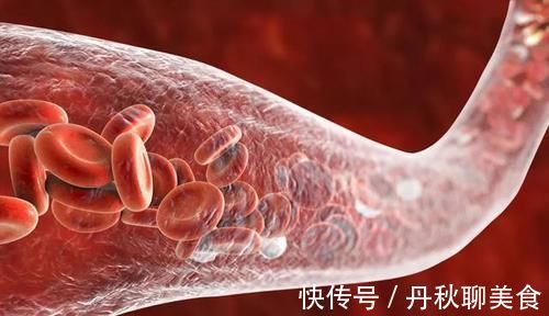血液粘稠度|血液黏稠是血栓的第一步!出现这几个信号,立刻改善还来得及