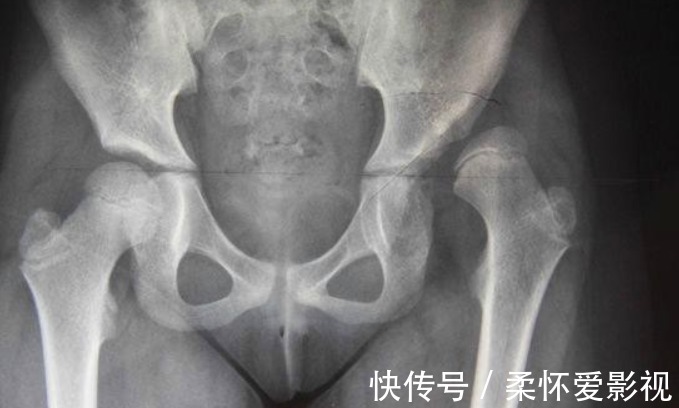 肌肉|这才是宝宝正常会走路的时间,过晚可能与疾病有关!