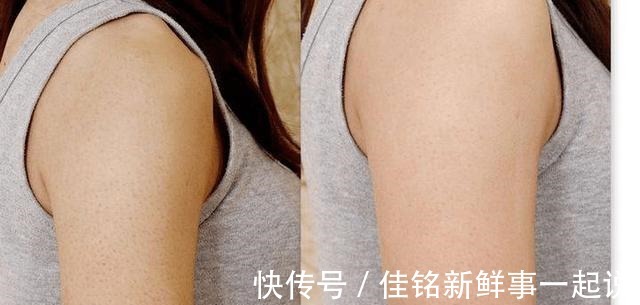 浴盐 仙女怎么能有鸡皮肤!养成光滑小腿,快试试这几个护肤方法!