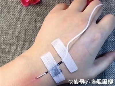 手上输液#小姐姐教你画“手上输液”,简单上手快,网友:怎么扎手腕了?