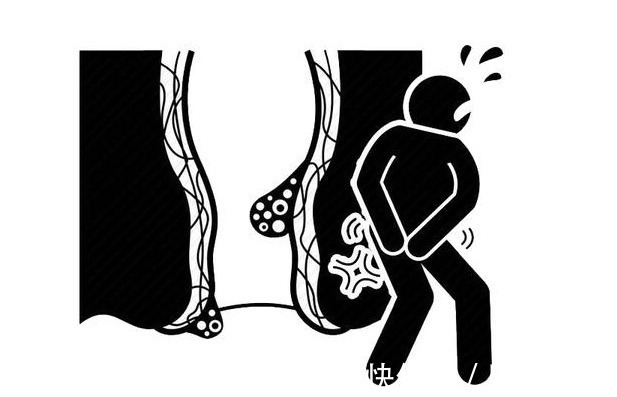 便秘|经常便秘要注意,3个危害在所难免,巧用3个方法,或许可以改善