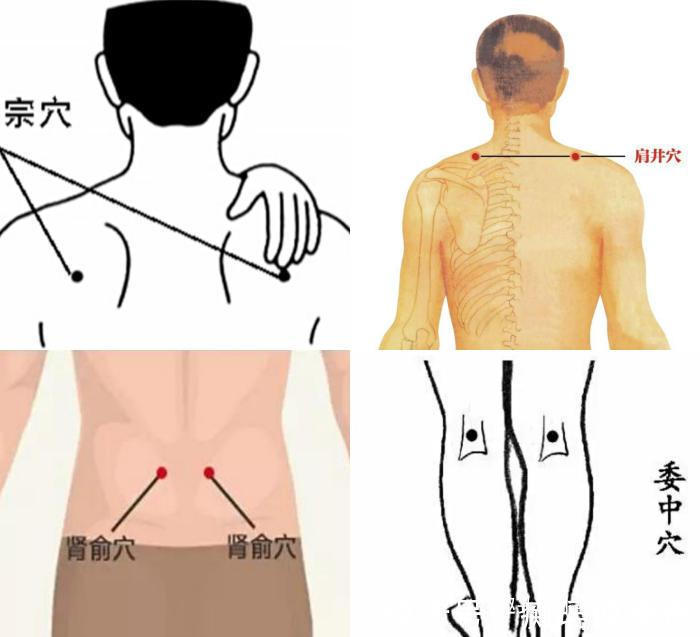 三伏贴|冬病夏治抓住一年中养阳的40天，阳虚的人记得提前安排好3件事