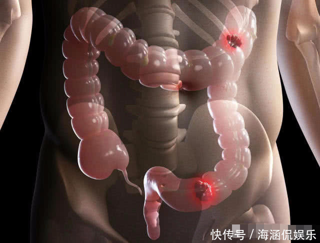便便|三天大便一次和一天大便三次,哪个危害更大,听了医生说都明白了