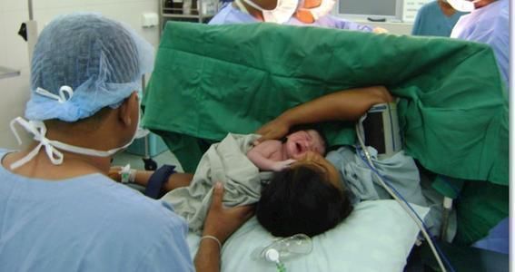 医生|为何有人生孩子疼得要命,有人却和上厕所一样简单医生说出内幕